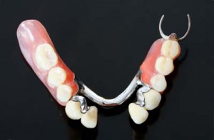 Partial Denture